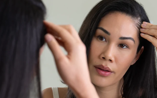 Hair Regrowth Treatments That Are Different from Traditional Solutions